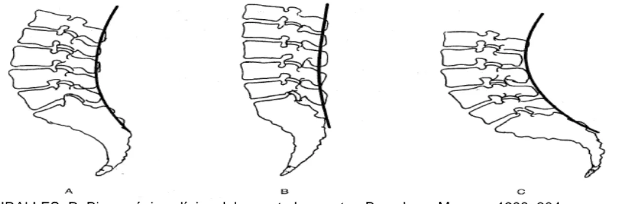 Figura  5.  Orientación  en  el  plano  sagital  A)  sacro  neutro.  B)  sacro  vertical