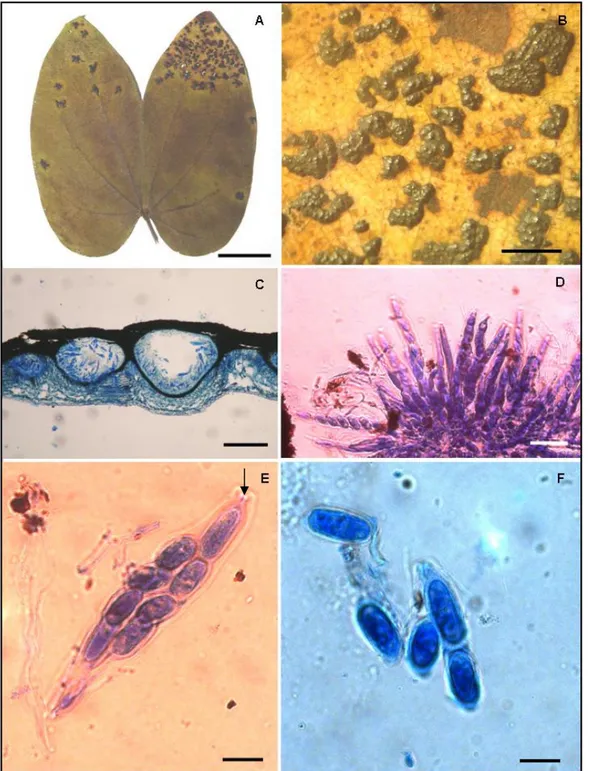 FIGURA 4. A-F Phyllachora spec. nov. No 2, en hojas de Bauhinia glabra (Fabaceae). A –  Lámina foliar con lesiones estromáticas (barra = 2 cm)