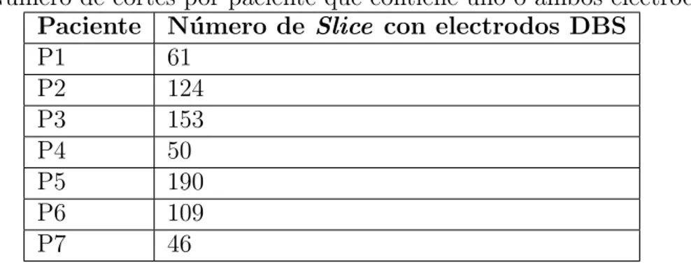 Tabla 2: N´ umero de cortes por paciente que contiene uno o ambos electrodos DBS Paciente N´ umero de Slice con electrodos DBS