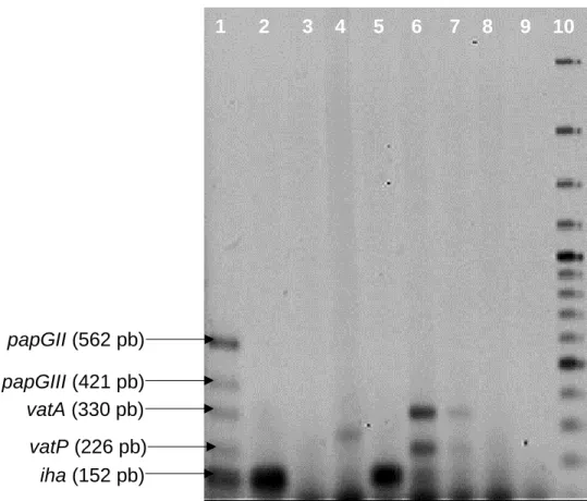 Figura  4.  Determinación  de  genes  de  virulencia  de  UPEC  por  PCR  múltiple  2