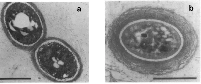 Fig. 2 Proceso  de enquistamiento de  A. vinelandii. a) Fase temprana del desarrollo  del quiste 12 horas  post-inducción