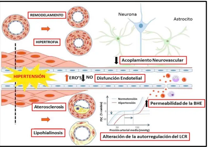 Figura  2.  Efecto  de  la  HAS  sobre  los  vasos  sanguíneos  cerebrales.  ERO’s,  especies  reactivas  de  oxígeno; NO, óxido nítrico; BHE, barrera hematoencefálica; FSC, flujo sanguíneo cerebral (Tomado  de Faraco &amp; Iadecola, 2013)