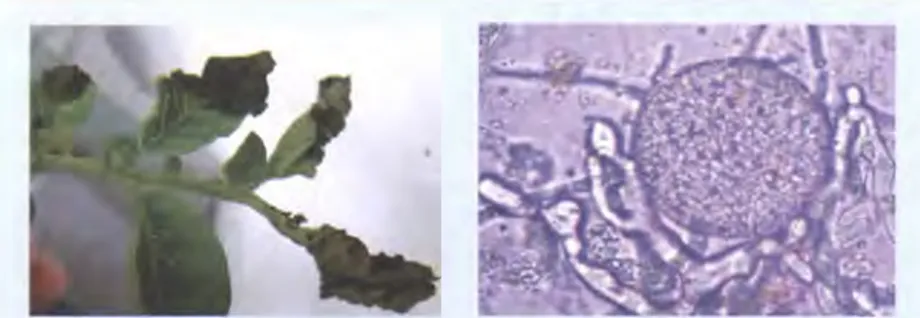 Figura  2. a)  Hoja de papa con síntomas de tizón  tardío , b) agente causal del  tizón tardío  Phytophthora infestans  (Mont)  de zBary