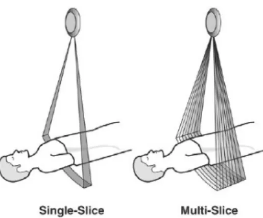 Figura 14: Esquema de las localización de los detectores dentro del arco.