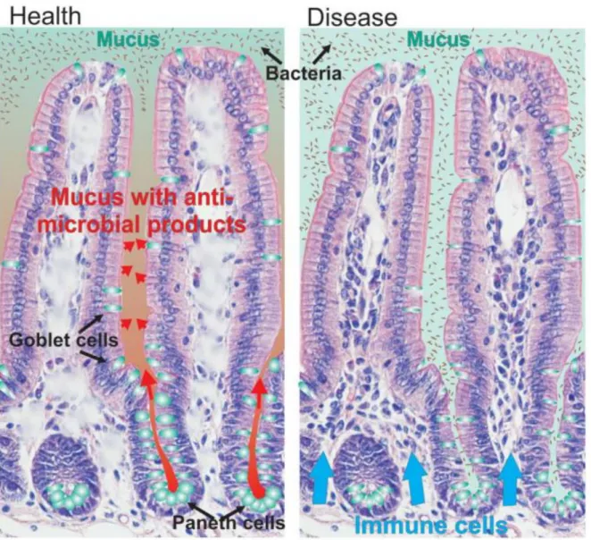 Figura 9. Mucus intestinal en Enfermedad de Crohn (41) 