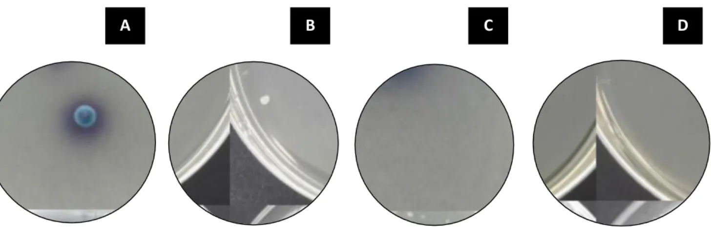 Figura 4. Identificación presuntiva mediante un medio cromogénico (CHROMagar TM Candida  Medium) de especies de levaduras del género Candida
