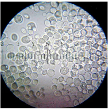 Figure 1.1: Saccharomyces cerevisiae[1].