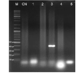 Figura 12. Electroforesis en gel de agarosa al 2% teñido con bromuro de etidio del producto de  amplificación del gen L1 con los oligonucleótidos MY09/11 