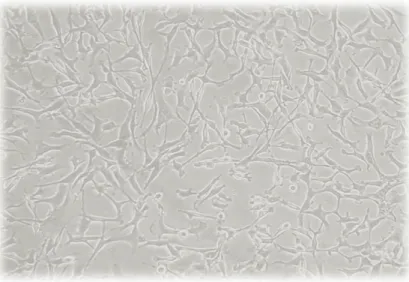Figura 6 Microfotografía de células MDA MB 231 