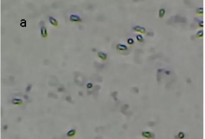 Figura  10:  Tinción  de las  células  de  Bt  con  verde  de  malaquita posterior  al  tratamiento
