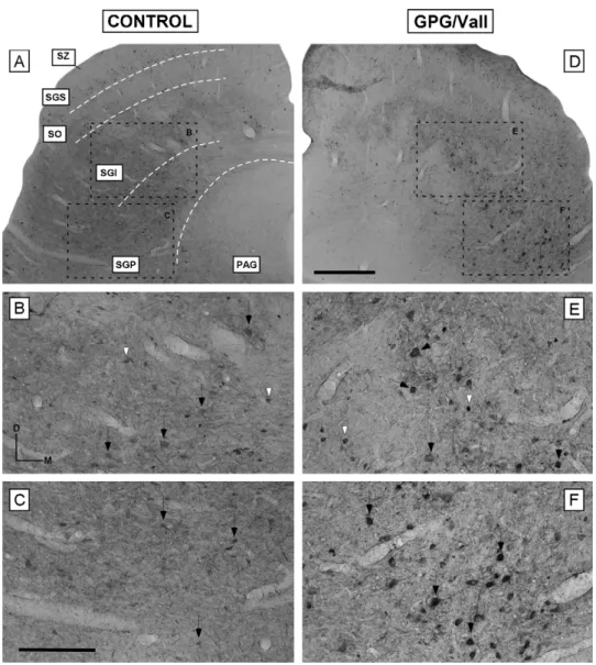 Figure 7 Digital images illustrating the distribution of parvalbumin immunostaining in the deep layers of the SC in control (A—C) and epileptic (D—F) animals