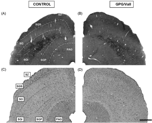 Figure 1 Low-magniﬁcation digital images showing AChE (A and B) and cresyl-violet (C and D) stained coronal sections of the SC in control and epileptic animals