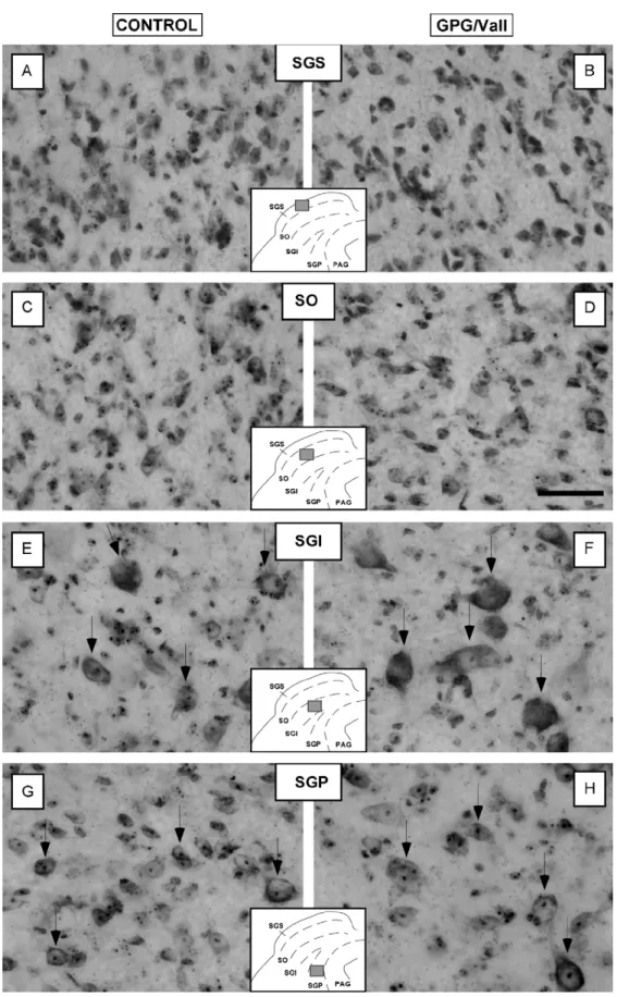 Figure 2 High-magniﬁcation digital images illustrating Nissl-staining in coronal sections of the SC in control (A, C, E and G) and GPG/Vall (B, D, F and H) hamsters