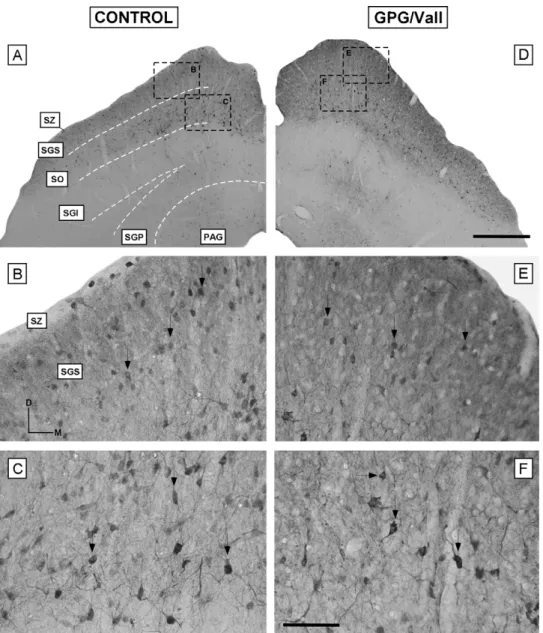 Figure 4 Digital images illustrating the distribution of calbindin immunostaining in the superﬁcial layers of the SC in control (A—C) and epileptic (D—F) animals