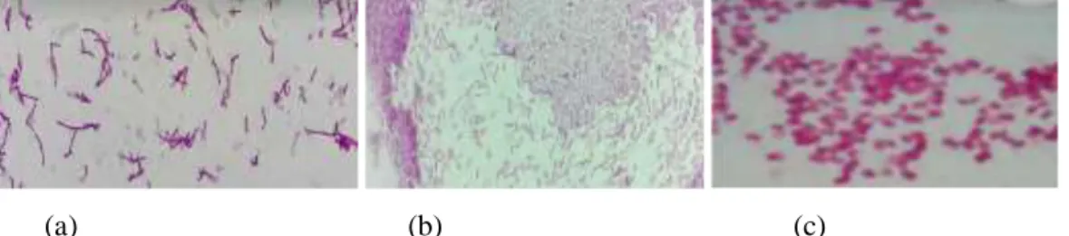 Figura 13.capturas de imágenes en microscopio de las cepas sospechosas (a) bacilos positivos  con endosporas característico de Pseudomonas, (b) bacilos positivos característicos de Bacillus  (c) cocos característicos de Azotobacter; laboratorio Inía, (ener