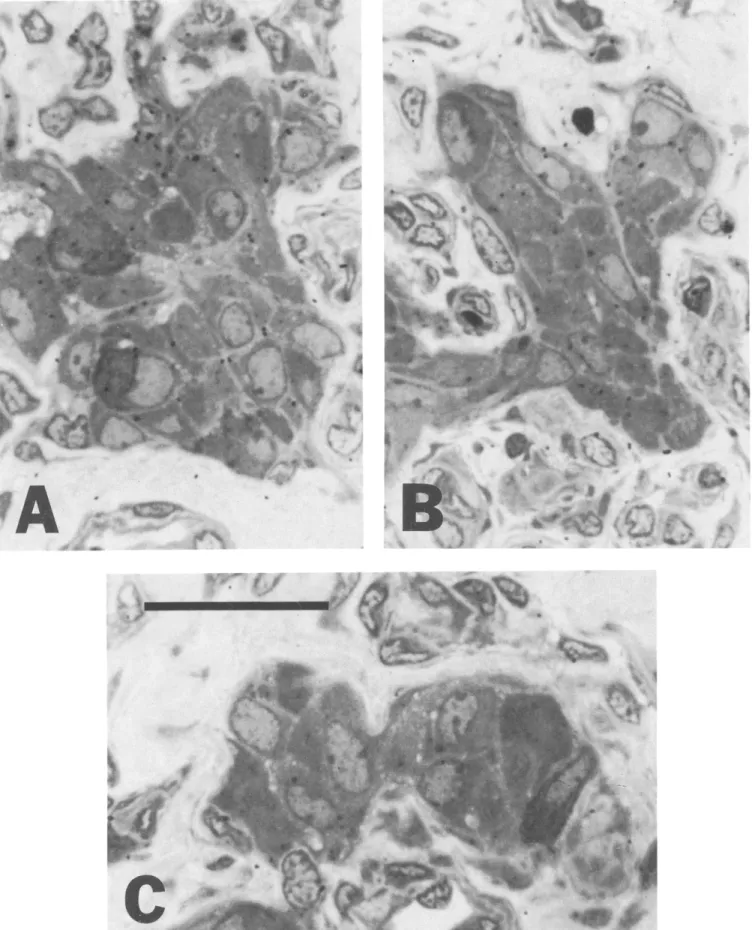 Fig.  4.  Autoradiographic  distribution  of  [3H]QNB  binding in  Iobules  of  type  I  and  type  1I  cells  in  rabbit carotid  bodies;  (A  and  B)  normal