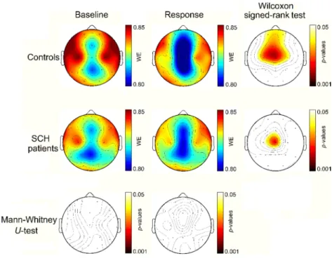Figure 3. Sensor-level topographic maps of the statistics computed for  WE ST  between  controls and SCH patients