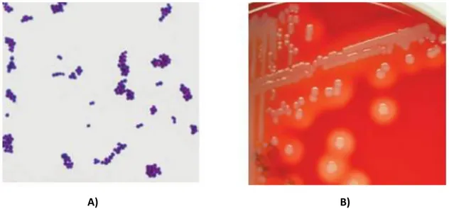 Figura 1.A) Tinción Gram de Staphylococcus aureus que muestra cocos grampositivos. B) Colonas  de Staphylococcus aureus en una placa de Agar Sangre después de la incubación de 24  horas