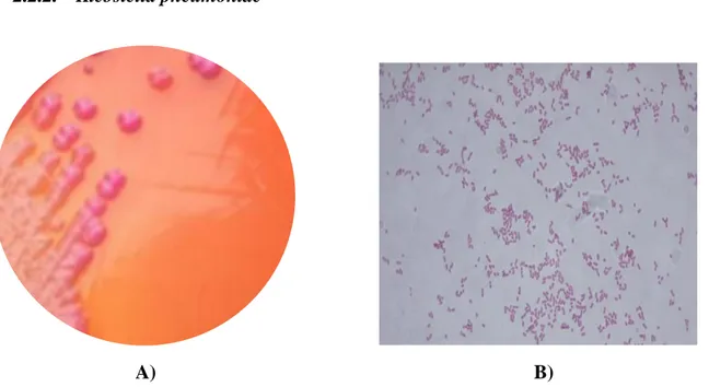 Figura 2. A)Colonias de Klebsiella pneumoniae en agar McConkey. B) Tinción Gram de Klebsiella  pneumoniae.