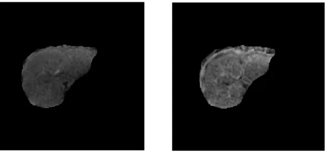 Figure 3.6: Estimated ADC from the original sequence and the registered one (from left to right).