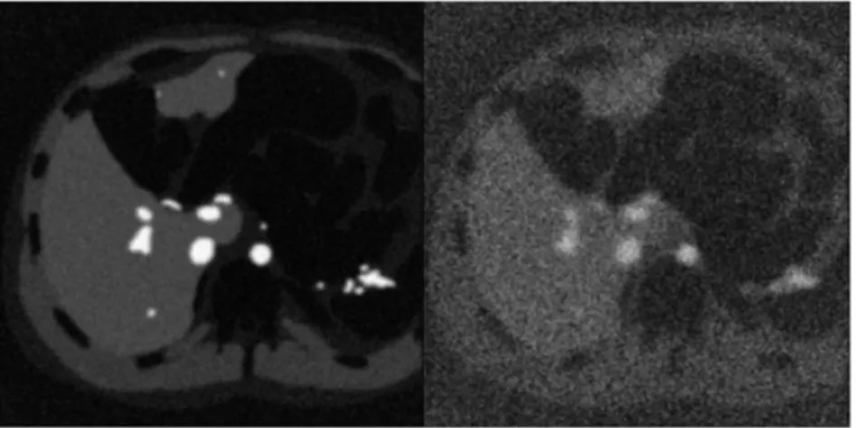 Figure 1.7: Simulated DW images of the liver for b 0 (left) and a b-value of 500 s/mm 2 