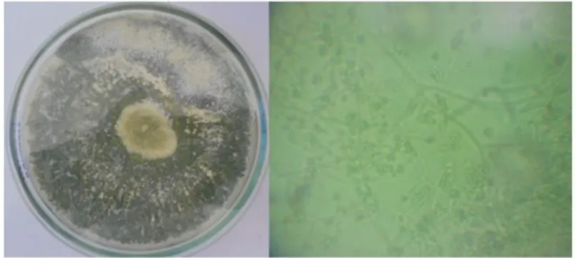 Figura 9. Observación macroscópico y microscópico del desarrollo del hongo  Trichoderma spp, en el laboratorio de Microbiología de la FCCBB-UNA PUNO, junio 