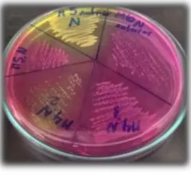Figura 4. Placas Petri con agar Mueller Hinton para Staphylococcus spp y M-  H con sangre desfibrinada para antibiograma de Streptococcus spp