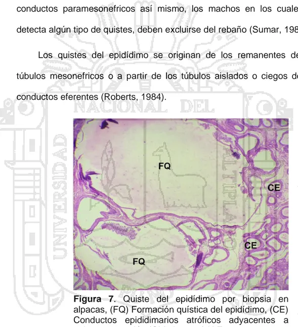 Figura  7.  Quiste  del  epidídimo  por  biopsia  en  alpacas, (FQ) Formación quística del epidídimo, (CE)  Conductos  epididimarios  atróficos  adyacentes  a  quiste por presión (Objetivo 10x) H.E