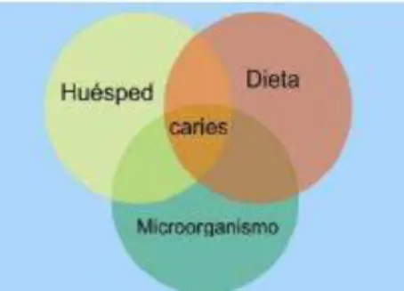 Figura  Nº  1  Triada  de  Keyes  Adaptado  de:  Henostroza  G.  Caries  delntal:  Principios  y  procedimientos  para  el  diagnostico