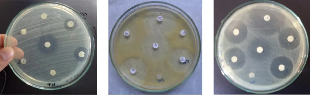 Figura 23. Fotografía de la resistencia in vitro de Escherichia coli a los antibióticos,  durante los meses de octubre a diciembre 2016