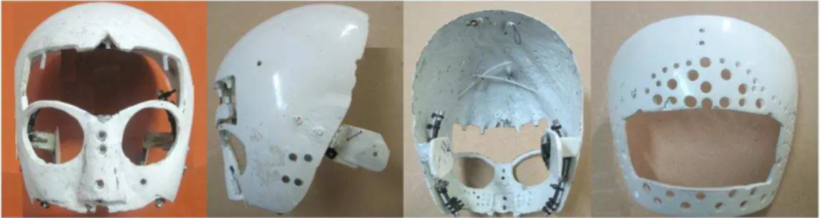 Figura 2.2   Vista: frontal, lateral y trasera del cráneo junto con su cubierta. 