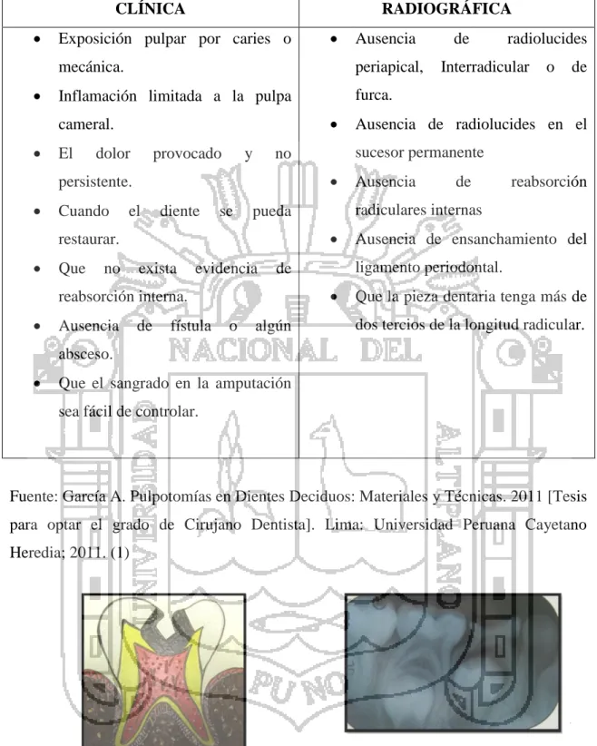 Fig. 2  Esquema  de  la  avance  de 