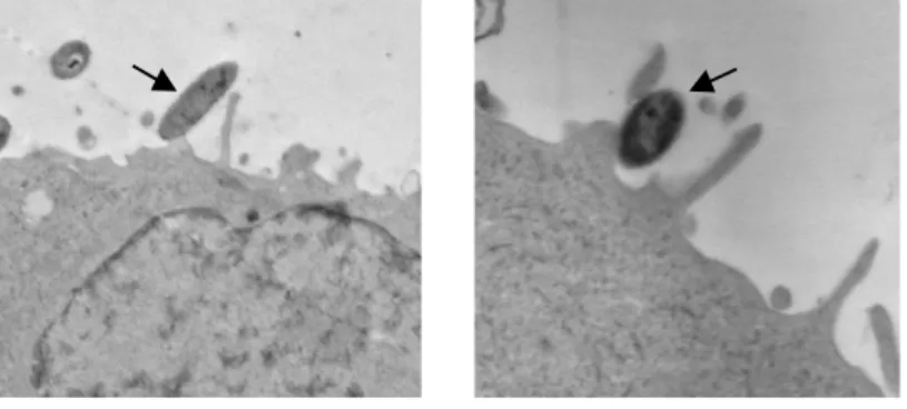 Figura  13.  Microscopía  electrónica  de  transmisión  mostrando  la  adhesión  de  HiNT398  a  la  superficie del macrófago alveolar MH-S