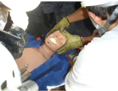 Figura 4. Vía aérea con control de columna cervical 