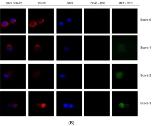 Figure 5. Detection of MET expression using tumor cancer cells with the CellSearch ® and Parsortix systems (A and B, respectively)