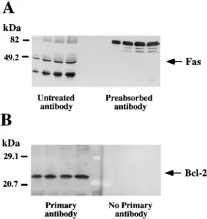 Figure 1 Representative autoradiographs of Western blots depicting labelling of immunodetectable pro-apoptotic Fas receptor (A) and anti-apoptotic Bcl-2 oncoprotein (B) in rat brain membranes.