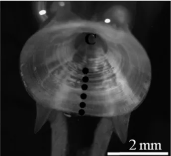 Fig. 4. – Vertebra from a specimen of Aphanopus carbo caught off  mainland Portugal, with 1036 mm total length and 6 years