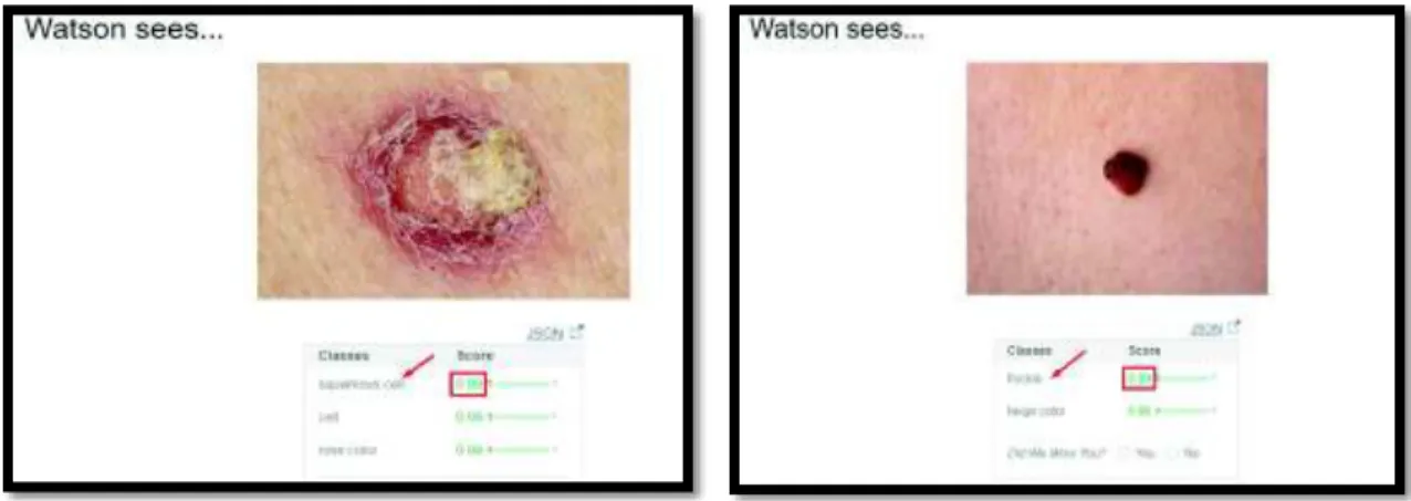 Figura 1.4. IBM Watson Reconocimiento Visual. 