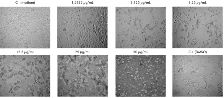 Figure 3. Micrographs of CHO K-1 cell line cultures, obtained by optic microscopy (40× magnification) at 36 h after treatment with differenct concentrations of amor- amor-phous silica nanoparticles (NPs)