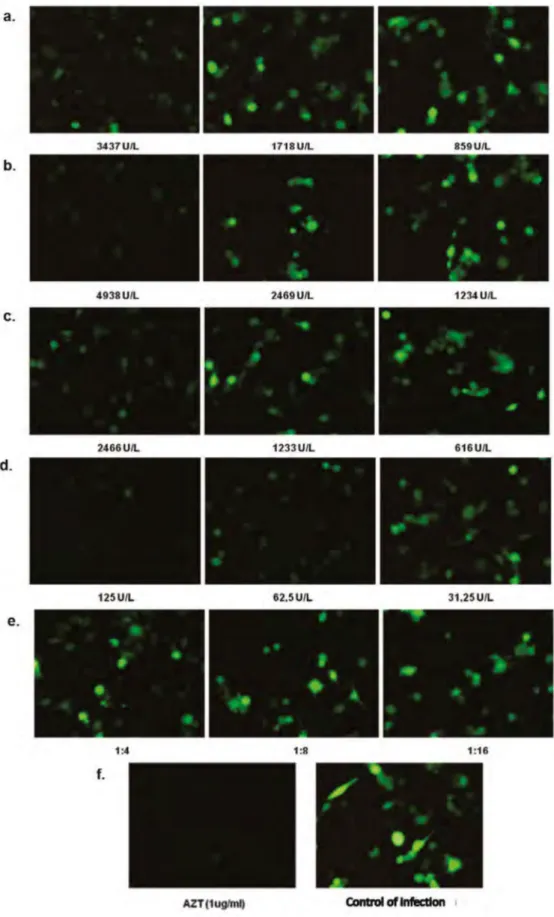 Figure 3. GFP expression in U373-MAGI cells infected with HIV-1-GFP in the presence of increased  concentrations of the EE