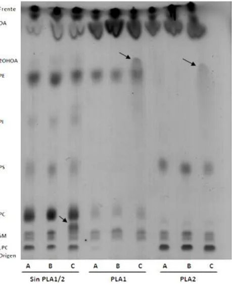 Figura  7.  Placa  de   cromatografía    en  capa  fina con los productos de  la digestión con 10 U/mL  PLA1  y  20  U/mL  PLA2  durante  21  horas  de  los  extractos  celulares  de  A549  tratados  con  (A)  0μM  2OHOA/OA,  (B)  200μM OA y (C) 200μM  2OH