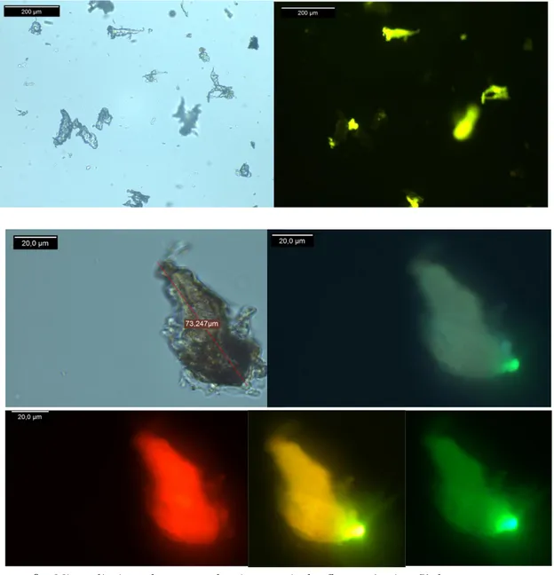 Figura  9.  Microplàstics  observats  al  microscopi  de  fluorescència.  S’observa  que  no  tots  els  microplàstics de la mostra presenten fluorescència (1)