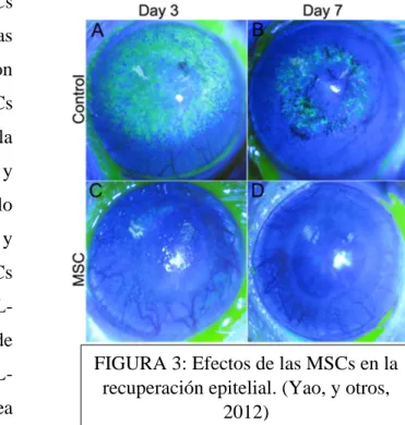 FIGURA 3: Efectos de las MSCs en la  recuperación epitelial. (Yao, y otros, 