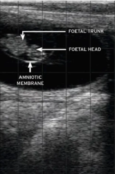Figura 2. Ultrasonografía día 38 de preñez (DesCôteaux &amp; Gnemmi, 2010). 