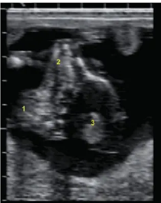 Figura 3. Imagen de ultrasonido de un feto hidrocefálico bovino (sonda 5 Mhz, profundidad  8 cm)