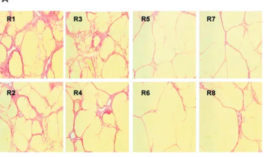 Fig. 3. Analysis of collagen in liver sections from rats submitted to CCl 4 inhalation and treated with P144 (eight rats) or with saline (eight rats)