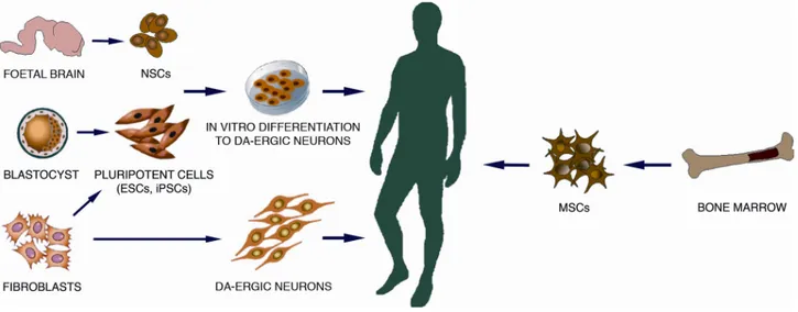 Fig  6:  Ilustración  esquemática  de  las  diferentes  fuentes  de  células  troncales  con  aplicación  terapéutica  para  la  EP  (Politis &amp; Lindvall, 2012) 