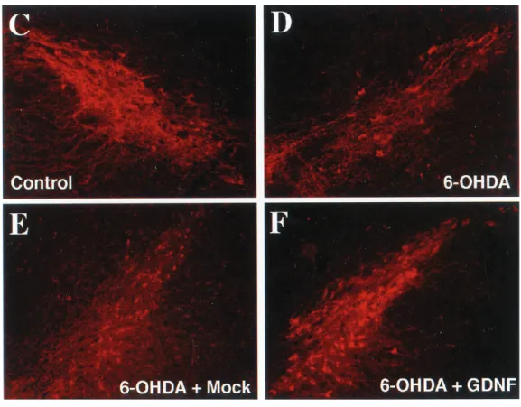 Fig 9: La prueba con inmunohistoquímica por TH revela que efectivamente la liberación de GDNF tiene un  efecto neuroprotector sobre las neuronas dopaminérgicas, como revela la imagen F, al compararla con el  