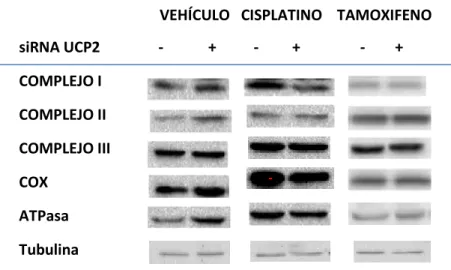 Figura  4.7.  Imágenes  correspondientes  al  Western  Blot  de  los  complejos  de  la  cadena  respiratoria  mitocondrial  de  las  células  sometidas  a  los  distintos  tratamientos  y  a  la  inhibición  de  la  UCP2  mediante un siRNA, la tubulina se