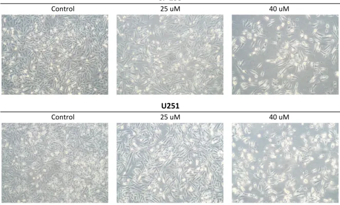 Figura  6.  Cambios  morfológicos  en  células  de  glioma  tras  48  horas  de  tratamiento  con  TGM6